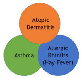 atopic dermatitis hay fever triad